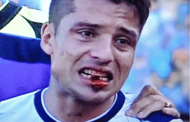 "Palacios salió corriendo y se chocó mi codo", dijo Quiroga - Cadena 3