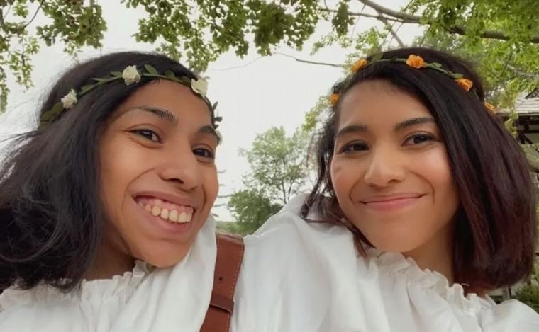 FOTO: Carmen y Lupita son hermanas siamesas y una de ellas tiene novio