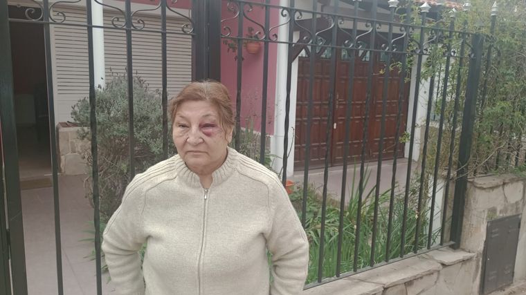 FOTO: Una mujer de 69 años se colgó de auto para que no se lo roben