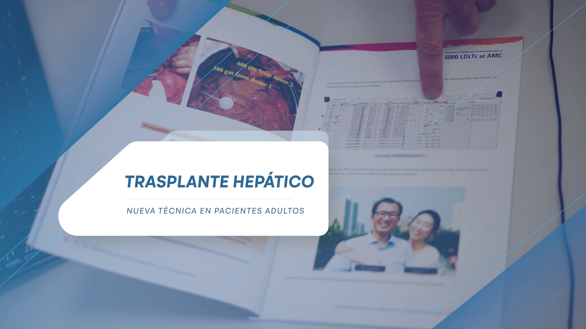 FOTO: Hospital Privado suma una técnica de alta complejidad para trasplantes hepáticos