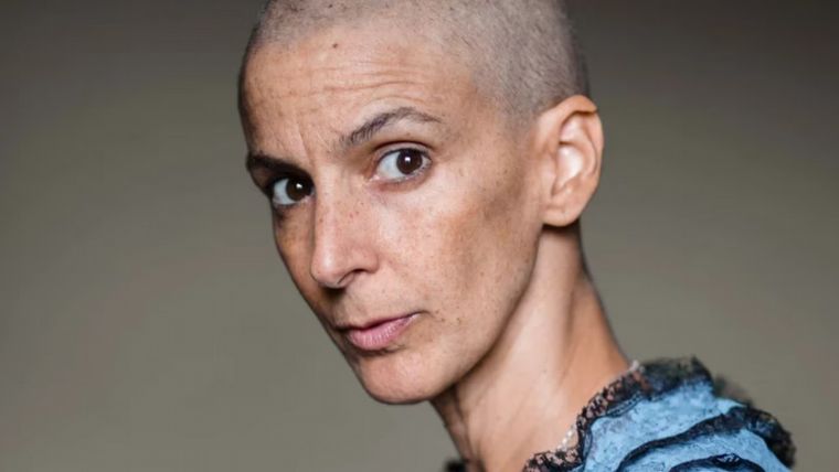 Superó el cáncer de mama y eligió vivir “con una sola teta” (Foto: @joberrojal)