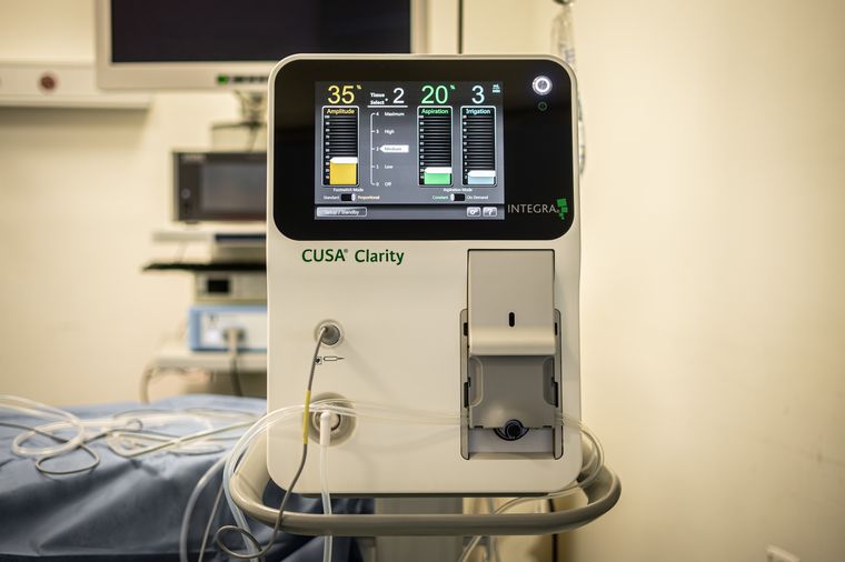 Nueva tecnología para cirugías más seguras: aspirador quirúrgico ultrasónico