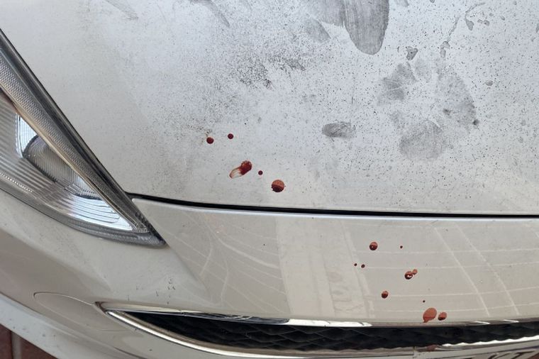 FOTO: En el auto quedaron manchas de sangre.