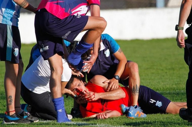 FOTO: Así quedó Agustín Becerra luego de la golpiza que recibió. (Foto: Olé)