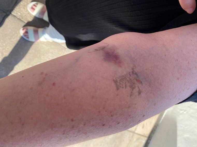 Salvaje golpiza a dos mujeres en barrio Jorge Newbery.