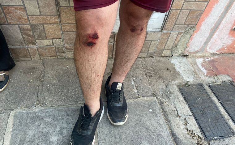 Asaltaron a un ex policía: "Buscaba matarme y mi mamá me salvó la vida".