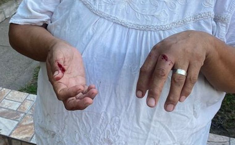 FOTO: El delincuente le cortó los dedos a una mujer tras robarle.