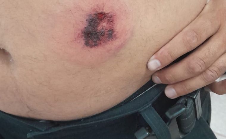 Balearon a policía para robarle la moto en Córdoba.