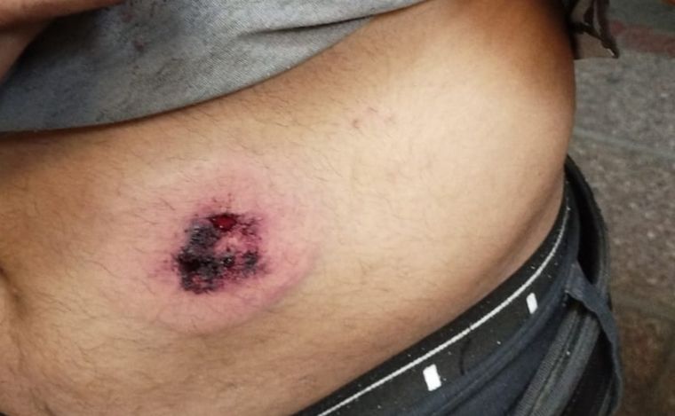 Balearon a policía para robarle la moto en Córdoba.