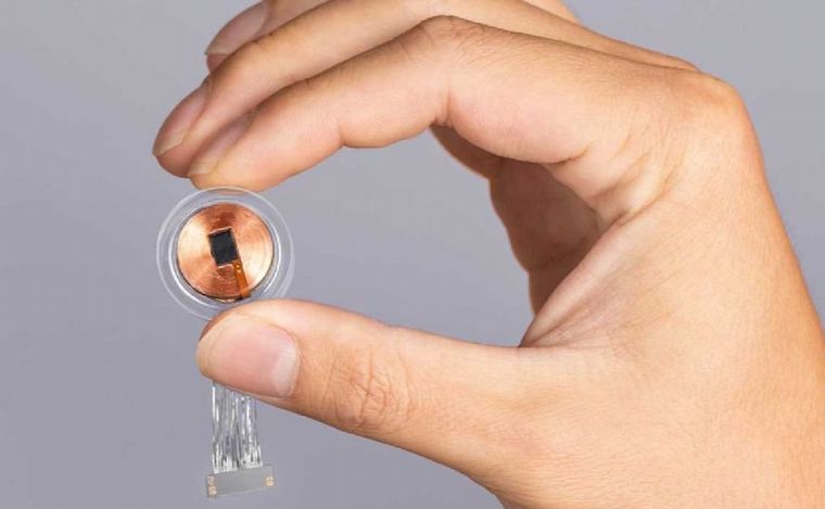 Cómo funciona el chip cerebral de Elon Musk. (Foto: gentileza)