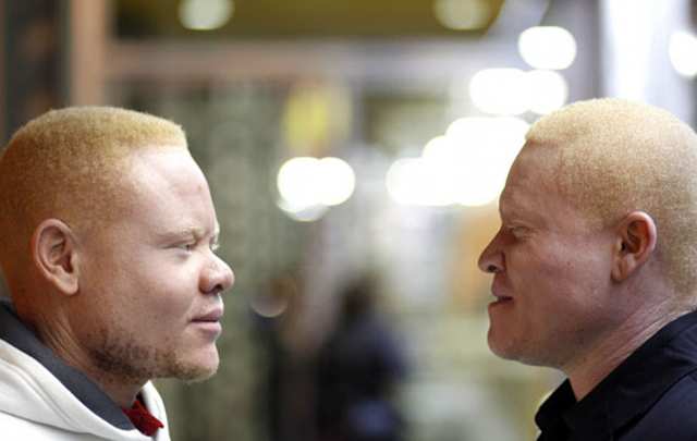 La Increible Historia De Dos Hermanos Negros Albinos Que Huyeron De Camerun A Espana Noticias Cadena 3 Argentina cadena 3