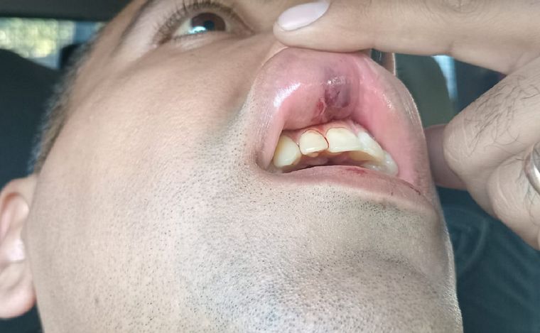 Policías agredidos en medio de un operativo en villa La Tela