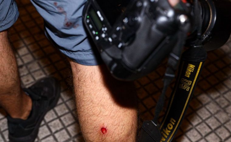 FOTO: Un reportero gráfico de Télam, herido con balas de goma.
