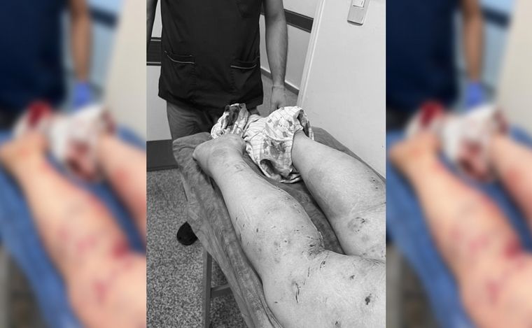 FOTO: La mujer atacada por la jauría fue trasladada al Hospital Florencio Díaz.