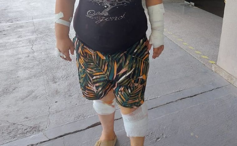 Así quedó la víctima tras el ataque. (Foto: Juan Federico/Cadena 3)