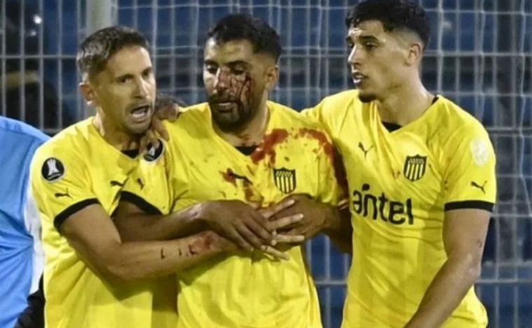 Olivera fue agredido con un proyectil.