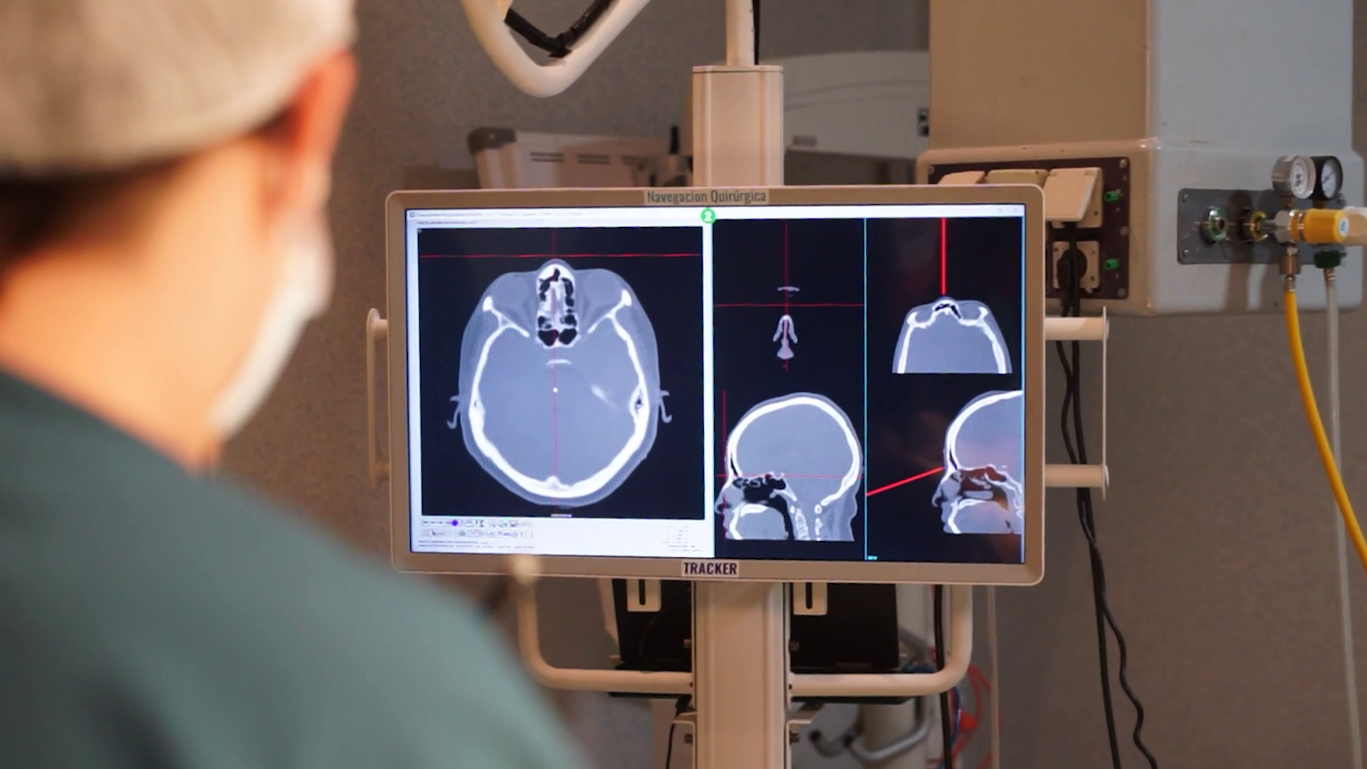 Navegador quirúrgico: precisión y seguridad en cirugías de alta complejidad