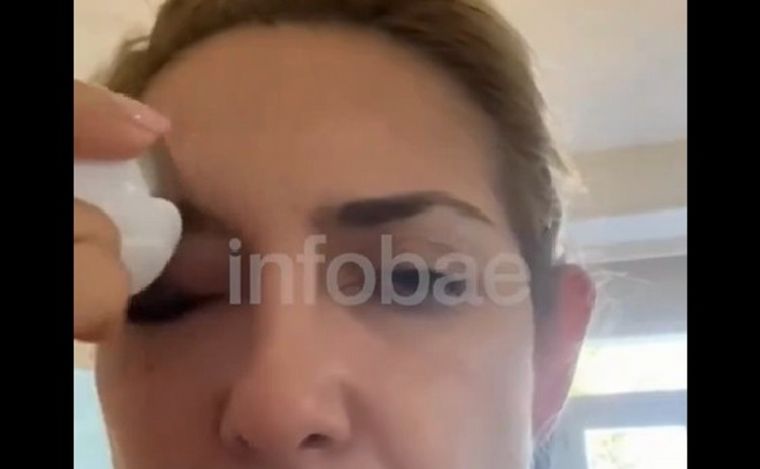 Fabiola Yañez presentó un nuevo video con un ojo morado. (Foto: captura)