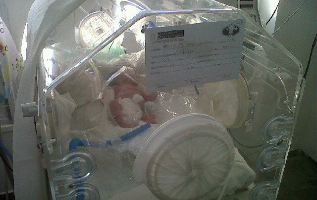 aureano Forelli, de 1,1 kilo, otro de los trillizos.