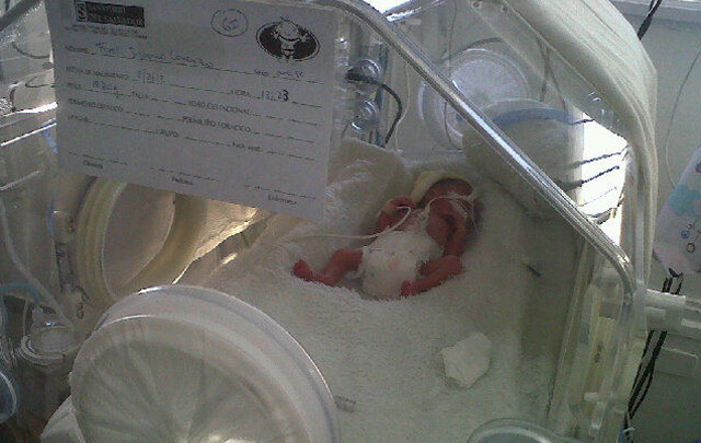 Lorenzo Forelli, de 830gramos, uno de los trillizos.