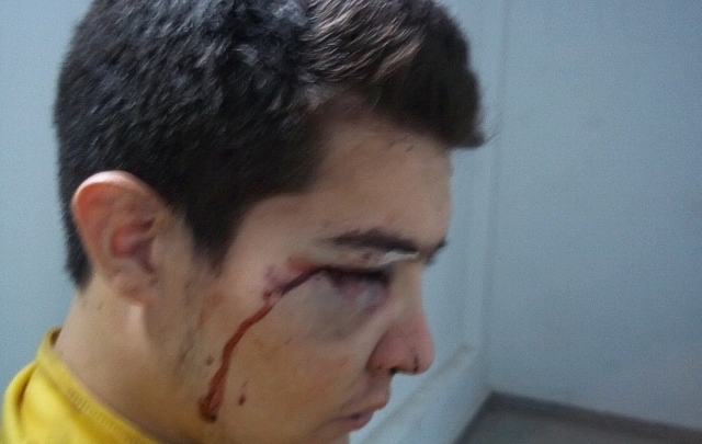 Matías Basavilvazo recibió un fuerte golpe en su ojo derecho.
