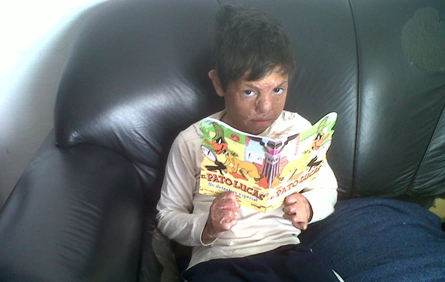 Tomás tiene 7 años y unas enormes ganas de mejorar su calidad de vida.