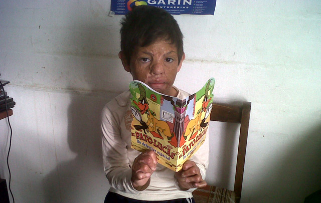 Tomasito asiste todos los días a clase, pero le duelen las manos al escribir.