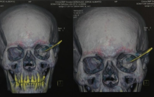 La hoja del cuchillo mide 9 centímetros.