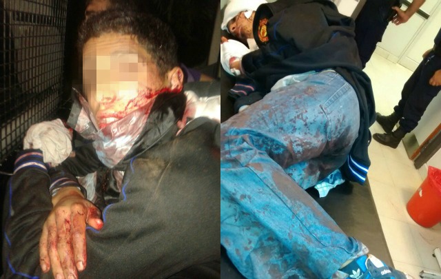 Los delincuentes heridos tuvieron que ser intervenidos quirúrgicamente.