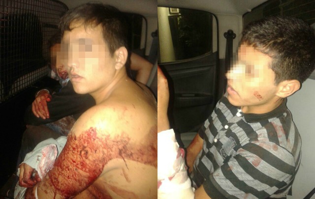 Los delincuentes heridos tuvieron que ser intervenidos quirúrgicamente.