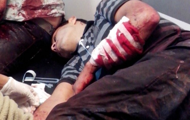 Los delincuentes heridos por el samurái fueron intervenidos quirúrgicamente.