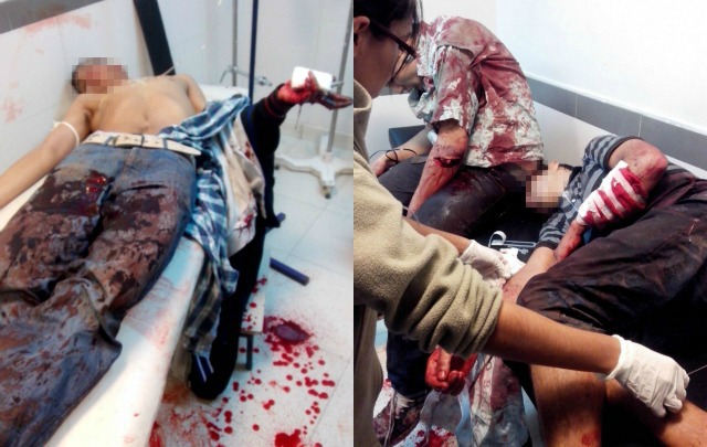 FOTO: Los delincuentes heridos tuvieron que ser intervenidos quirúrgicamente.