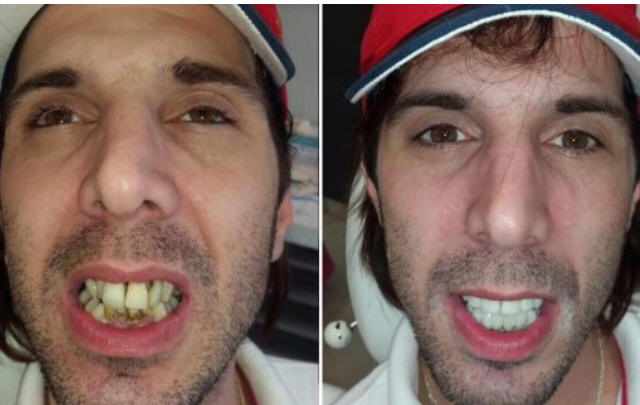 Bazterrica, con dientes nuevos.