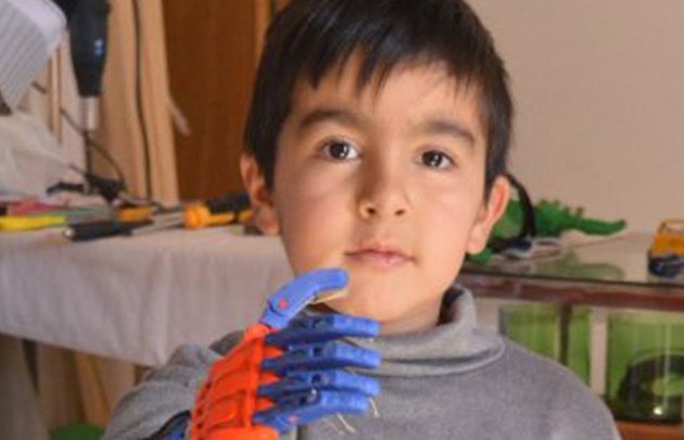 Ale nació con una malformación conocida como focomelio (Foto: El Tribuno).