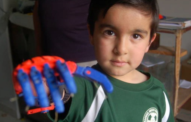 AUDIO: Le fabricó a su hijo un brazo ortopédico con una impresora 3D (Elisa Zamora).