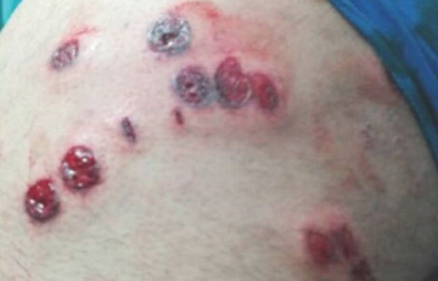 El joven recibió 11 impactos de balas de goma (Foto: Nueva Rioja).