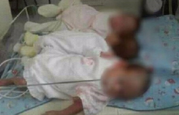 Las trillizas se encuentran internadas en el Policlínico Central de San Justo.