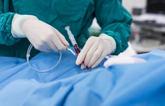 Se celebran 40 años de la angioplastia coronaria