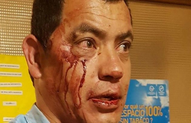 El policía sufrió cortes en su rostro.