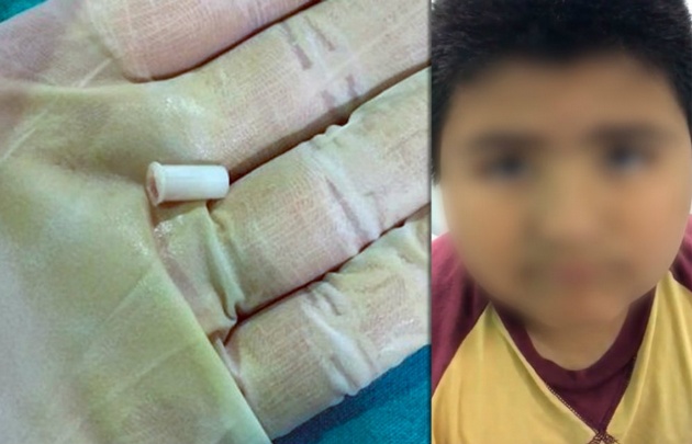 El niño fue atendido en el Hospital de Niños.