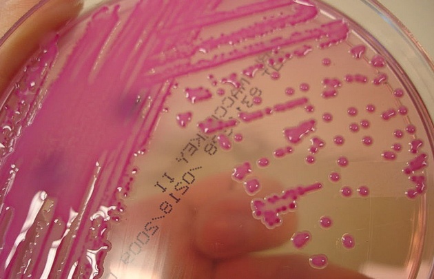 Klebsiella, bacteria intrahospitalaria.