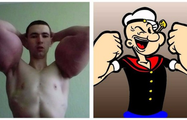 El fisicoculturista criticado por el tamaño de sus brazos y el entrañable Popeye.
