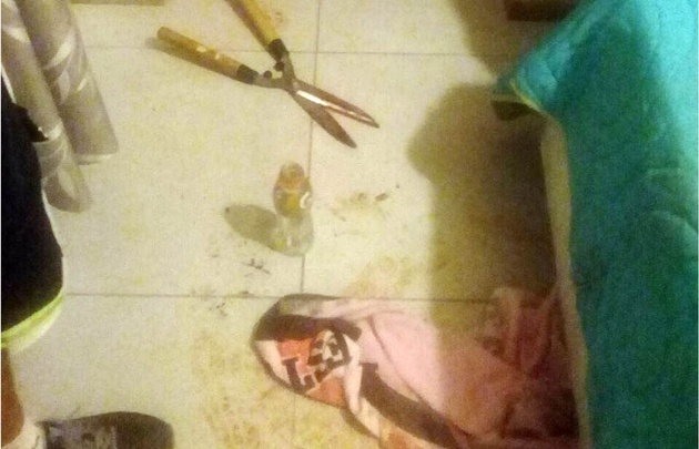 Las últimas fotos truculentas fueron las del caso del hombre mutilado.