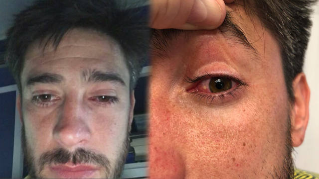 Pablo Pérez, tras el ataque: