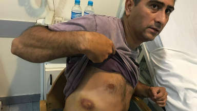 “Entraron a mi casa para fulminarme”, dijo Carrasco