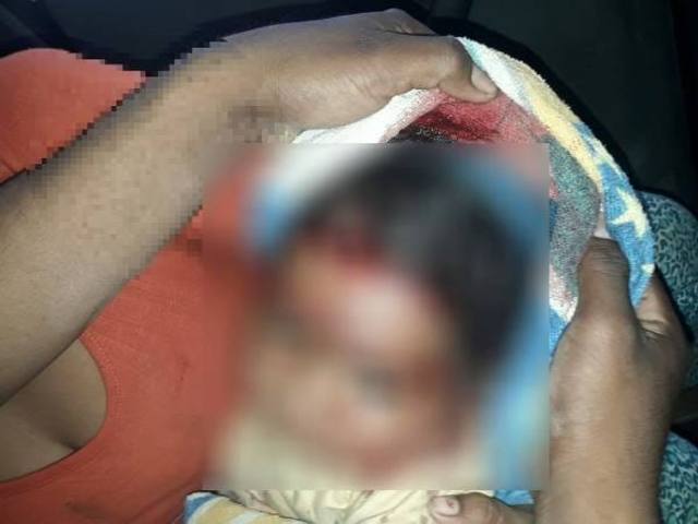 FOTO: Un bebé de la etnia wichi fue rescatado de un profundo pozo