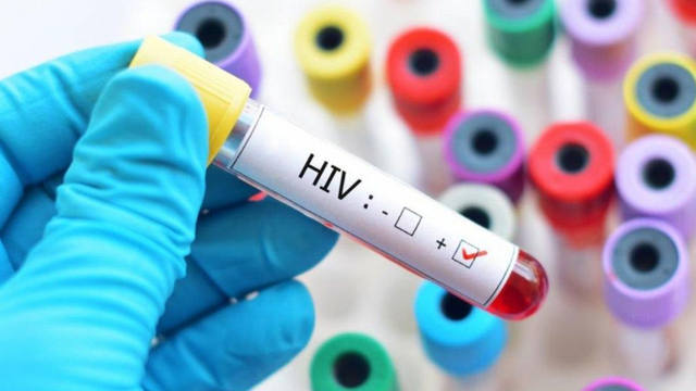 FOTO: Curaron a una persona con VIH por segunda vez en la historia