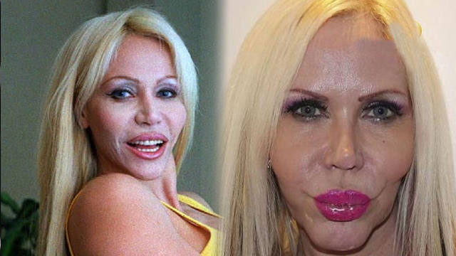 Alejandra Pradón reapareció en un programa de cirugías