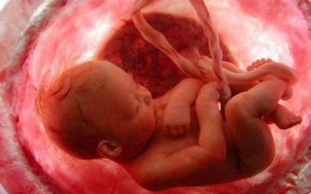 FOTO: Bebé sobrevivió a un aborto y después de varias horas murió
