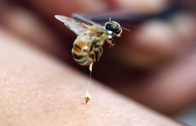 Abeja terapia veneno